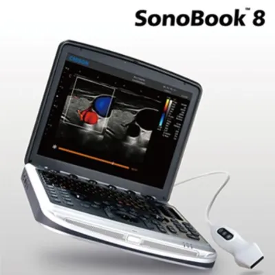 УЗИ-аппарат Chison SonoBook 8
